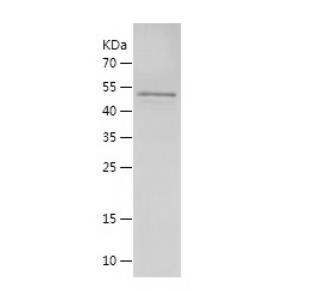 Recombinant Human Egr1.png