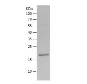 Recombinant Human Estrogen Receptor alpha.png