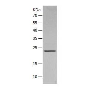 Recombinant Human FGF21.png