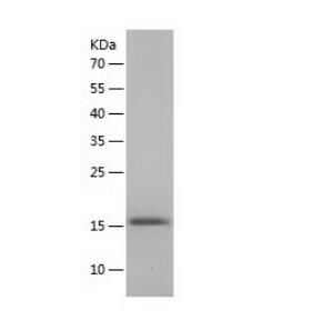 Recombinant Human Fibronectin type III EDB.png