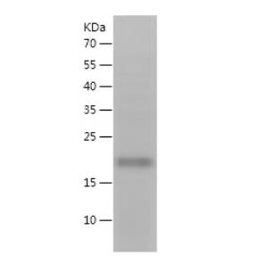 Recombinant Human Flt3 ligand.png