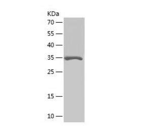 Recombinant Human GABARAP.png