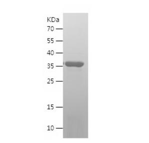 Recombinant Human GABARAPL2.png