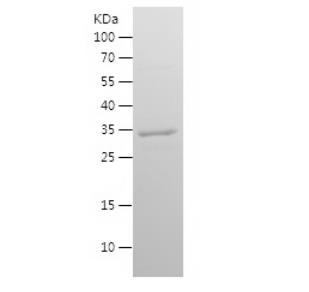 Recombinant Human GCDFP 15.png