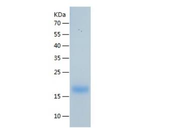 Recombinant Human G-CSF.png