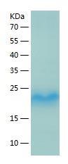 Recombinant Human GM2A.jpg