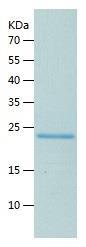 Recombinant Human GRB 14.jpg