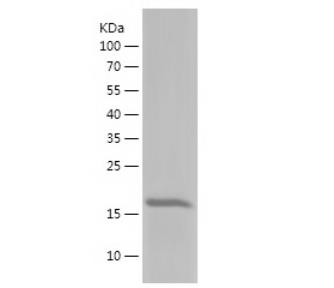 Recombinant Human IL-10.png