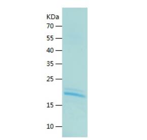 Recombinant Human IL-9.png