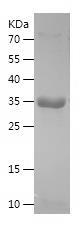 Recombinant Human Inhibin beta A.jpg