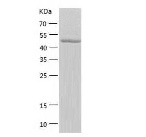 Recombinant Human Interferon gamma.png