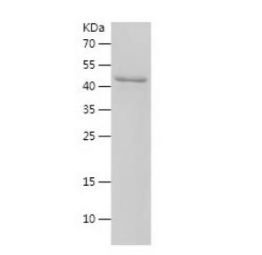 Recombinant Human MMP14.png