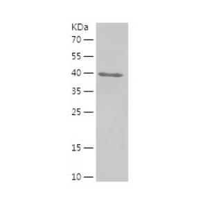 Recombinant Human MYL7.png