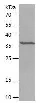 Recombinant Human NDUFA5.jpg