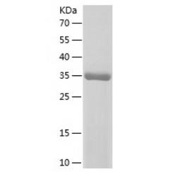 Recombinant Human NDUFS6.png