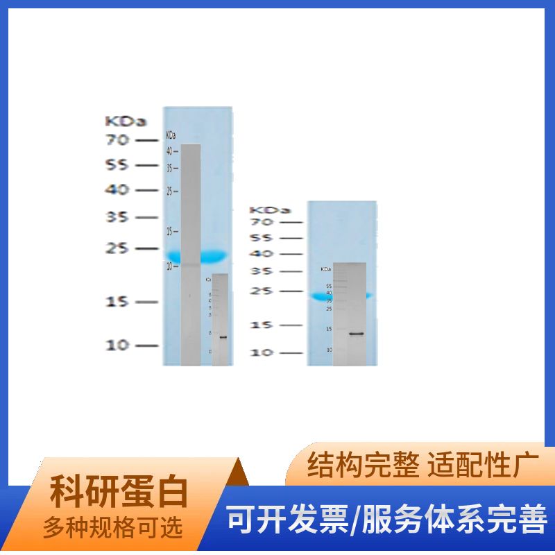 Recombinant Human Myosin Light Chain 2