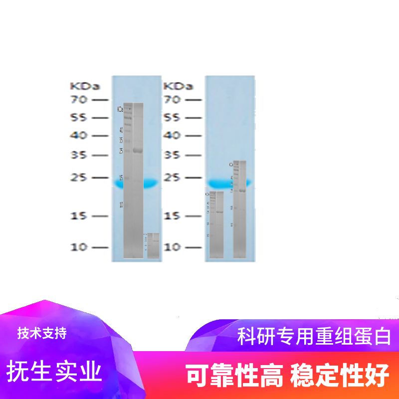 Recombinant Human PTN