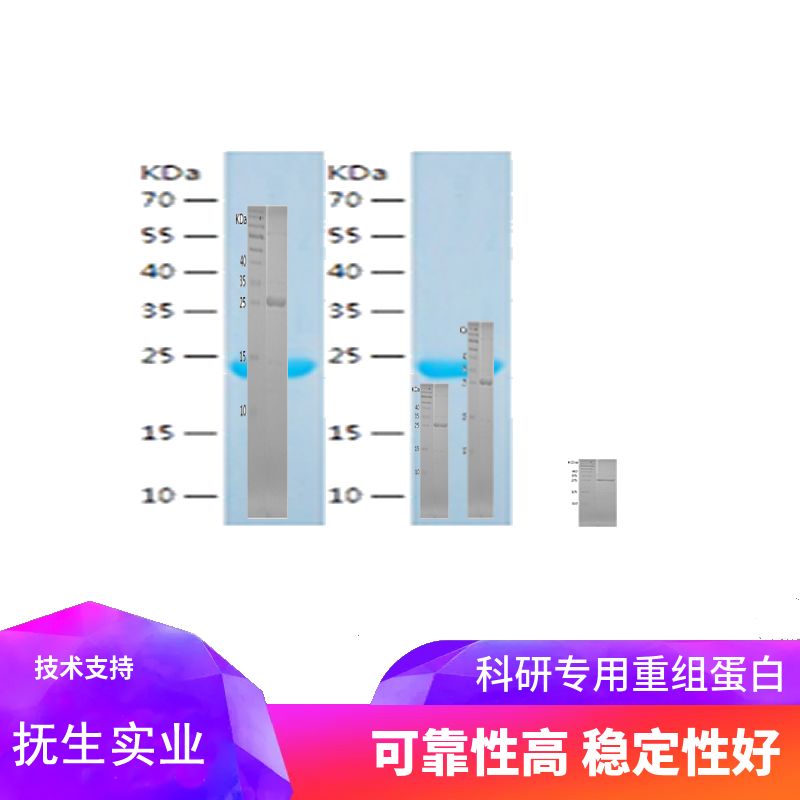 Recombinant Human LIF