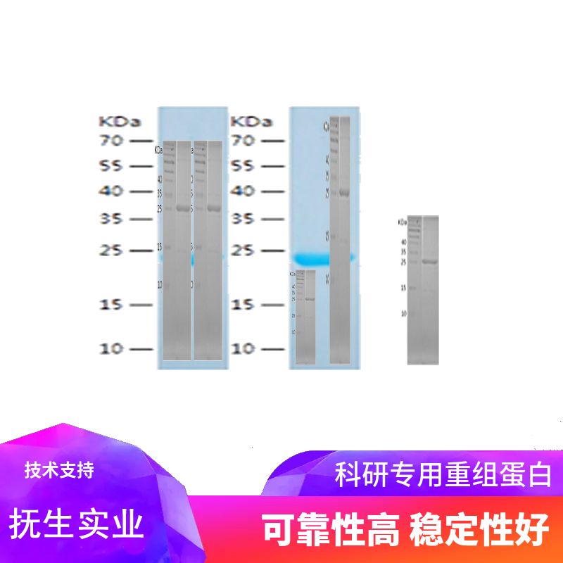 Recombinant Human S100P