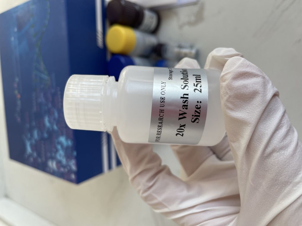 人尿酸(uric acid）ELISA试剂盒