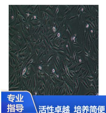 人胚胎横纹肌肉瘤细胞A204