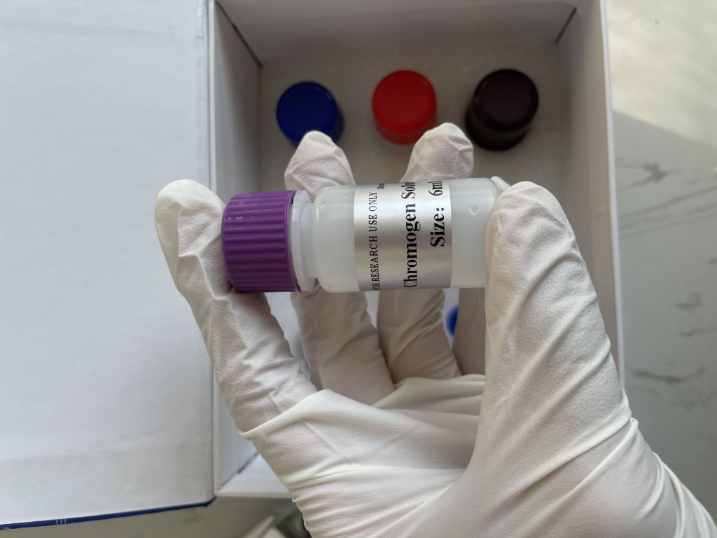 人髓过氧化物酶特异性抗中性粒细胞胞质(MPO-ANCA IgG）ELISA试剂盒