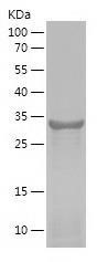 Recombinant Human PHF5A.jpg
