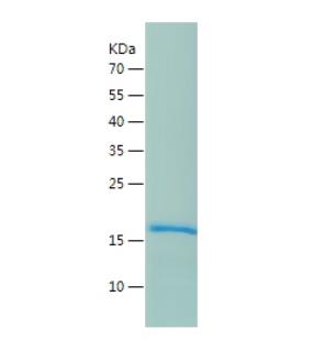 Recombinant Human PTN.png