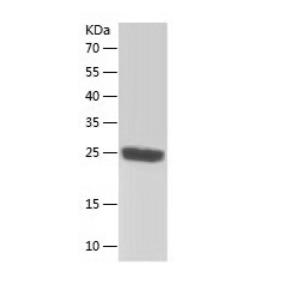 Recombinant Human RGS5.png