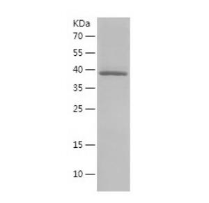 Recombinant Human RPL11.png