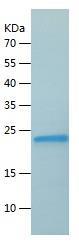 Recombinant Human RPL12.jpg