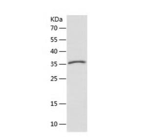 Recombinant Human RPL22.png