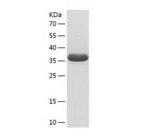 Recombinant Human RPS12.png