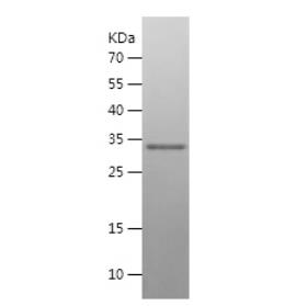 Recombinant Human S100 beta.png