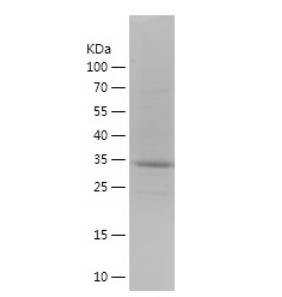 Recombinant Human S100A11.png