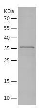 Recombinant Human S100A16.jpg