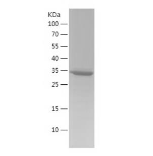 Recombinant Human S100A5.png