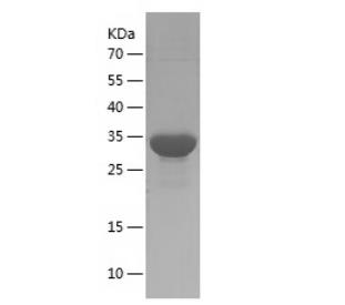 Recombinant Human S100A9.png