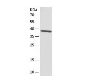Recombinant Human S100P.png
