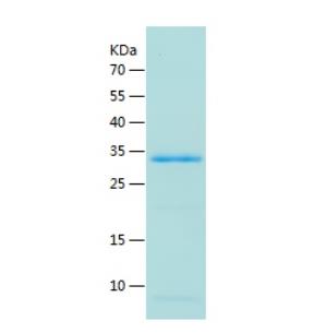 Recombinant Human SAA4.png