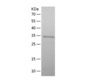 Recombinant Human SEC61B.png