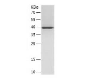 Recombinant Human SNX3.png
