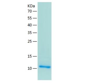 Recombinant Human SPINK1.png