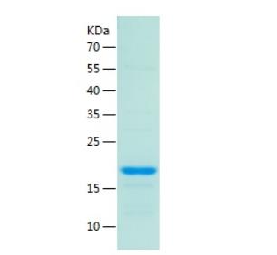 Recombinant Human Sumo 1.png