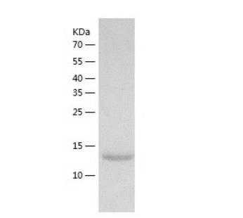 Recombinant Human Superoxide Dismutase 1.png