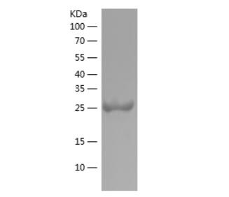 Recombinant Human TAU.png