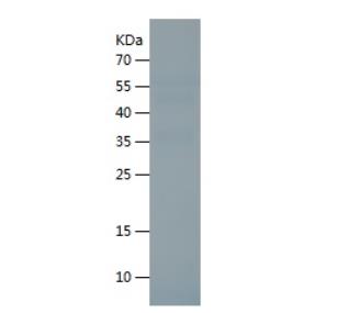 Recombinant Human TGF beta 3.png