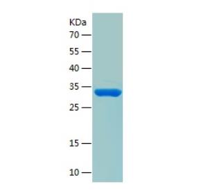 Recombinant Human TIMM8A.png