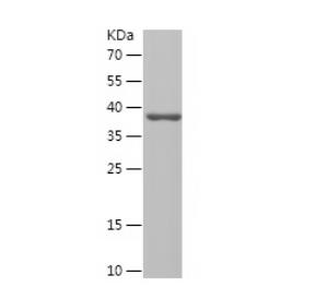 Recombinant Human USP5.png