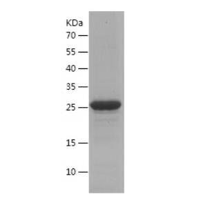 Recombinant TGF alpha.png
